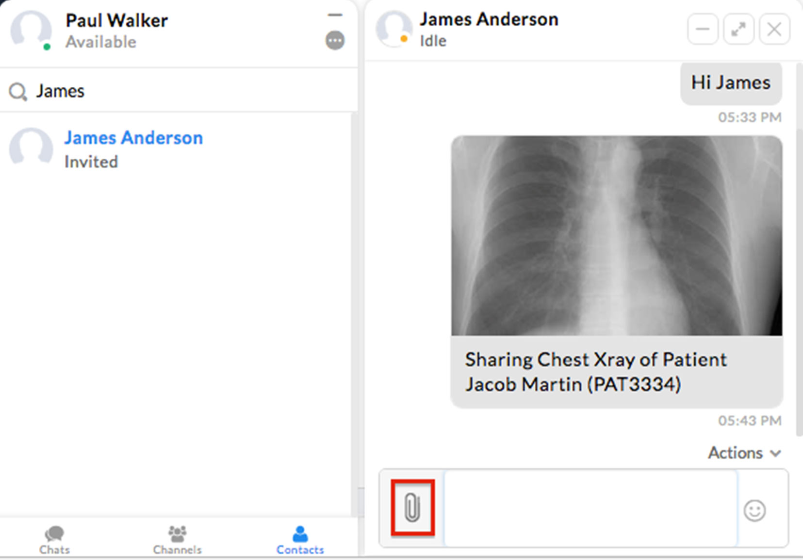 Share/Attach Documents